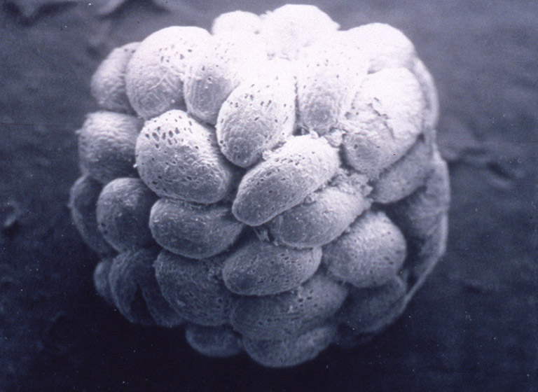A close-up photograph of many seeds attached into a ball.