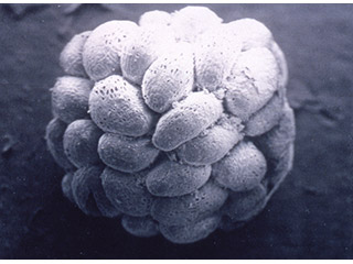 A close-up photograph of many seeds attached into a ball.