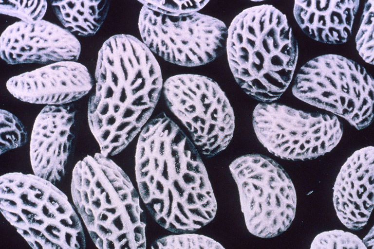 Several heavily patterned seeds in black and white.